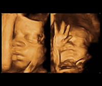 Paula 26 semanas
