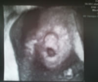 Marian - 20 semanas