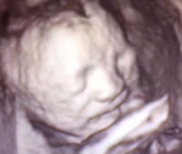 Isabella - 26 semanas