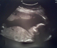 Gennaro - 23 semanas